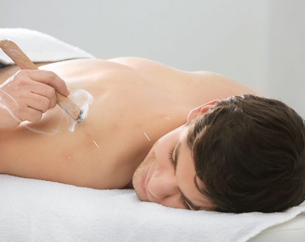 Acupuncture Chigwell Acupuncture Chigwell