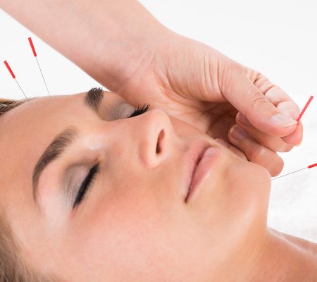 Acupuncturist Chigwell Acupuncturist Chigwell